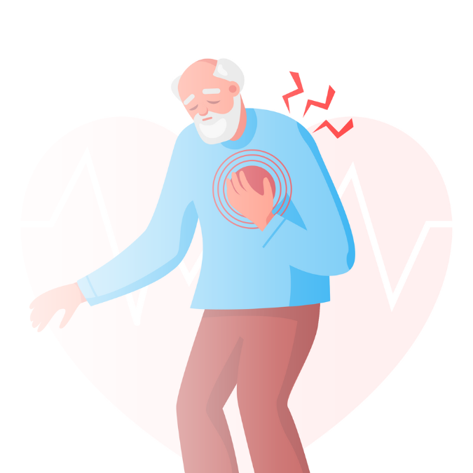 Doença Arterial Coronariana (DAC)