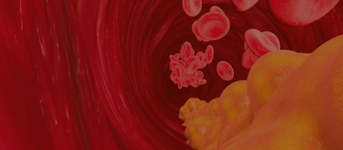 imagemposttrigliceridios